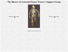 Tablet Screenshot of ilizarov.org.uk